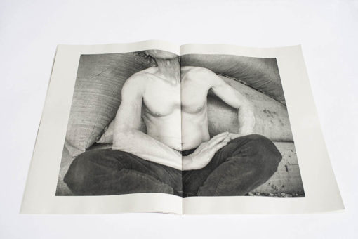 Pectus Excavatum - Quentin Yvelin – Image 10