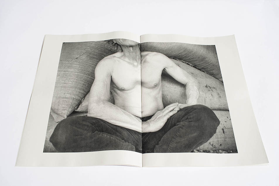 Pectus Excavatum - Quentin Yvelin – Image 10
